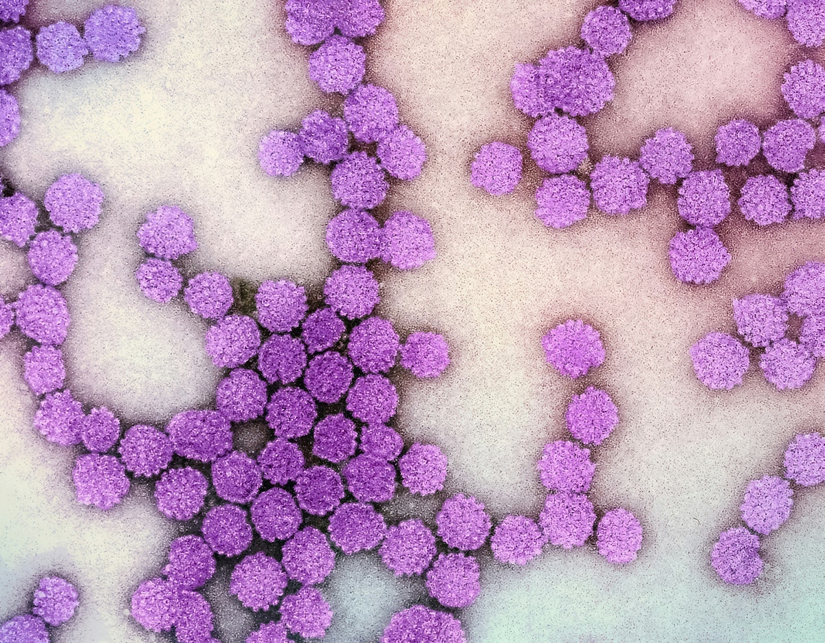 Colorized electron micrograph of HPV virus particles | Credit: National Institute of Allergy and Infectious Diseases (NIAID)