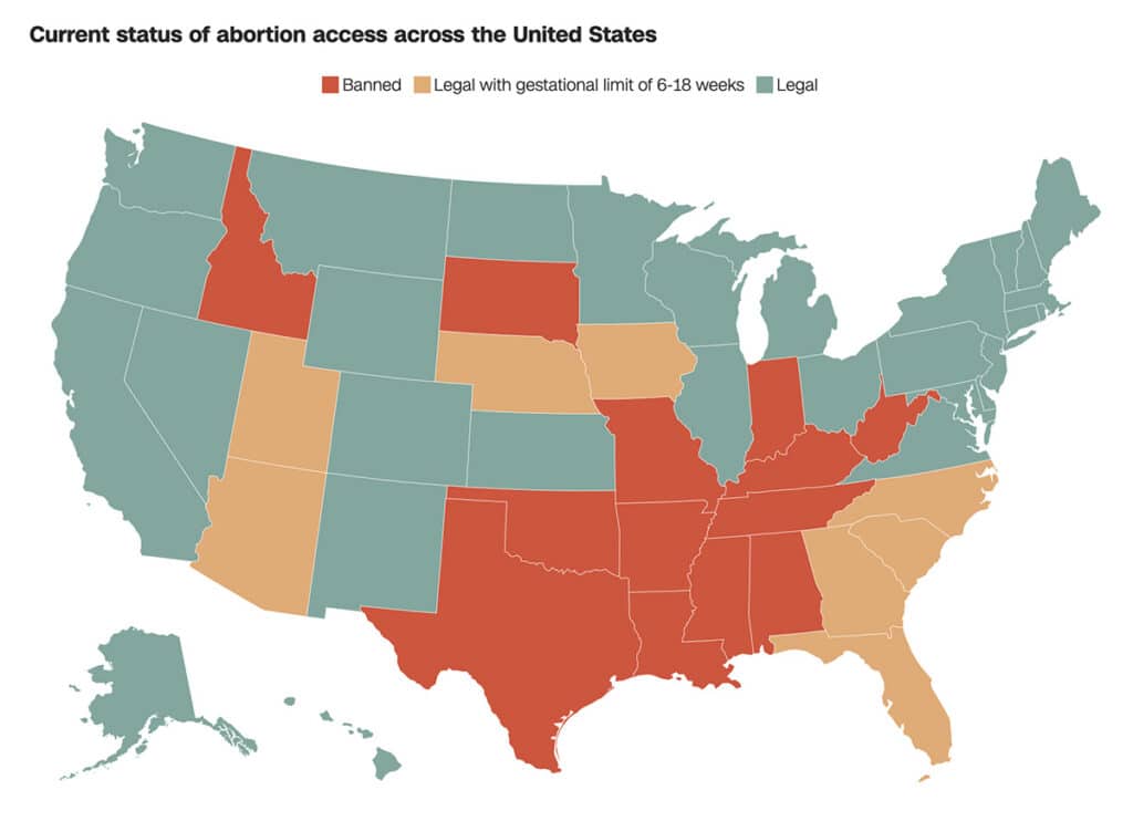 Map: Current status of abortion access across the US